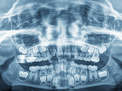 The image features a detailed view of an open human skull with visible teeth and nasal structures, set against a blue background.