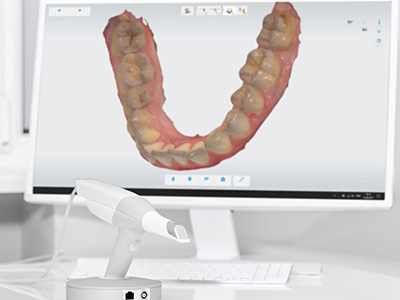 The image shows a computer screen displaying a 3D rendering of a dental implant being placed into a mouth, with a real-life dental implant device on a table in front of the monitor.