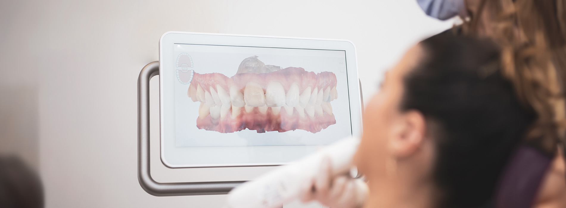 A person receiving dental care with a focus on teeth whitening, depicted through an edited photo effect that adds textures and shapes over the image, possibly for artistic or informative purposes.