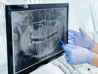 A medical professional wearing gloves is using a computer mouse to manipulate an X-ray image of a human skull on a screen, with the skull also visible in the foreground.