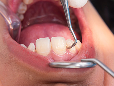 <html>
<head><title>500 Internal Server Error</title></head>
<body>
<center><h1>500 Internal Server Error</h1></center>
<hr><center>nginx/1.29.3</center>
</body>
</html>