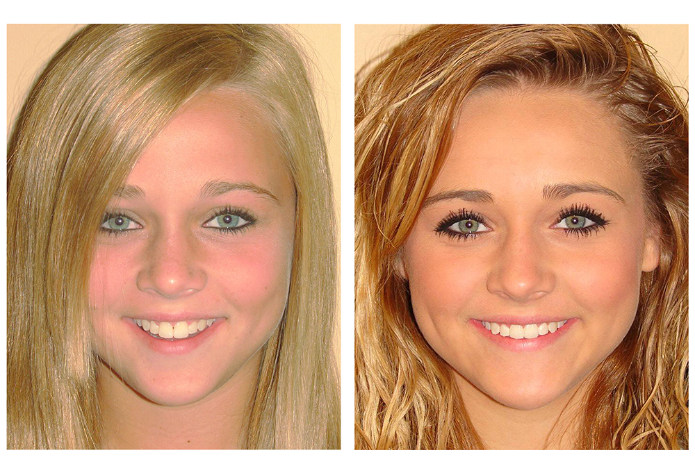 Myers Pediatric Dentistry Orthodontics